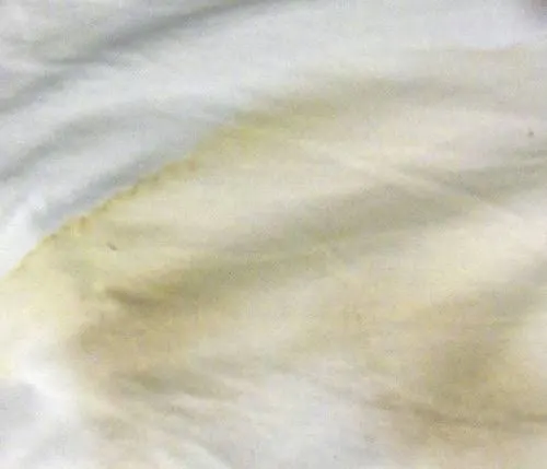 Brightening & discoloration re